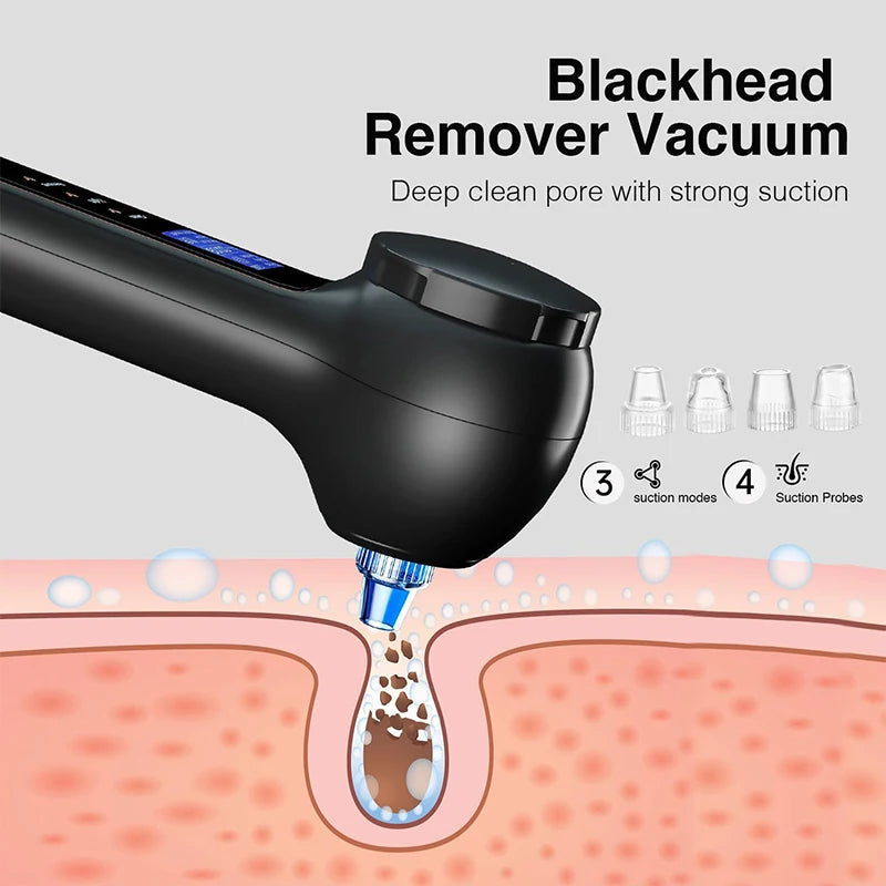 Brosse Nettoyante Visage 5-en-1 - Aspirateur Points Noirs